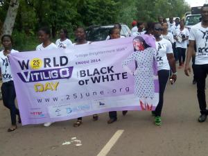 The Vitiligo Englightenment Walk, Coal City, ENUGU 2014