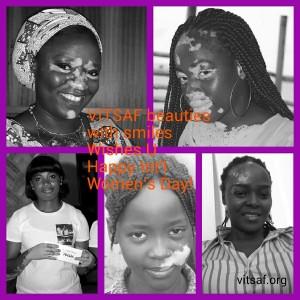 Celebrating Women living with Vitiligo & altered images